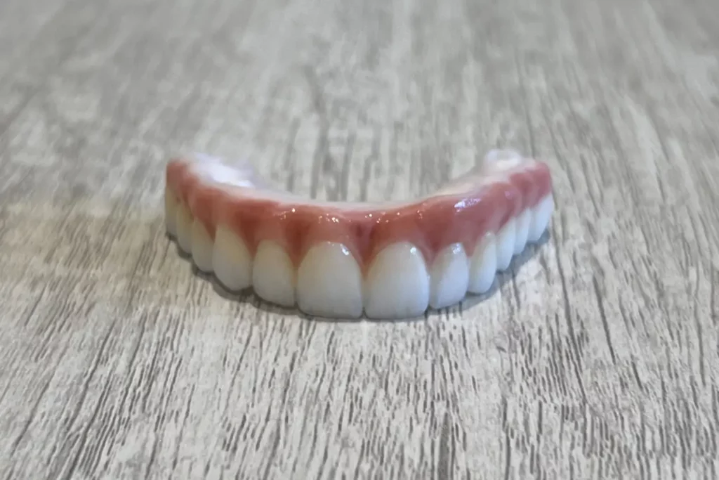 all-on-4 dental implants upper zirconia bridge